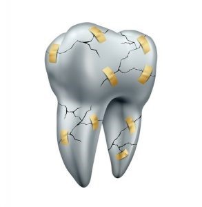 shekastegi-dandan روشهای درمان ترک خوردگی و شکستگی دندان