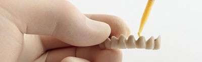 b2ap3_thumbnail_chasbe-dandan2 انواع چسب دندانپزشکی